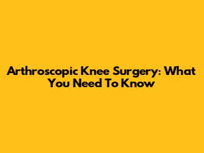 Arthroscopic Knee Surgery: What You Need To Know