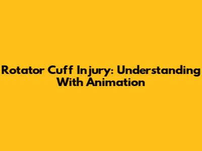 Rotator Cuff Injury: Understanding With Animation