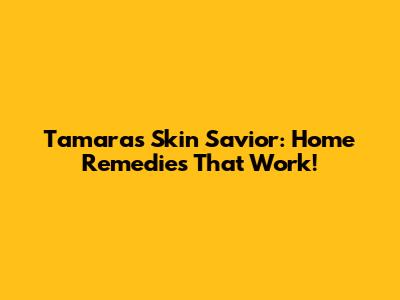 Tamara's Skin Savior: Home Remedies That Work!
