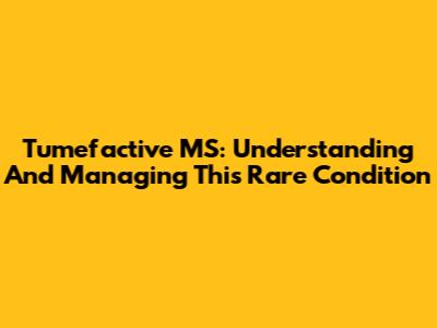 Tumefactive MS: Understanding And Managing This Rare Condition