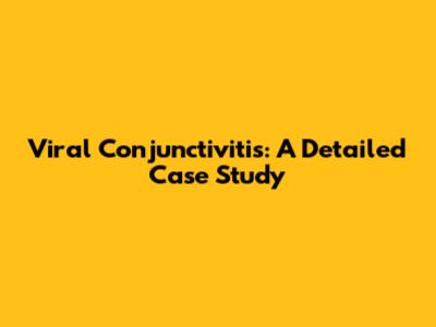 Viral Conjunctivitis: A Detailed Case Study
